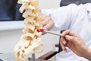 Guz srodrdzeniowy kregoslupa Guz srodrdzeniowy kregoslupa